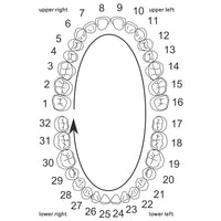 Quintuplet Gap