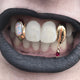 Twin Fangs (w/ Gemstone Inlay and Drip Blood)