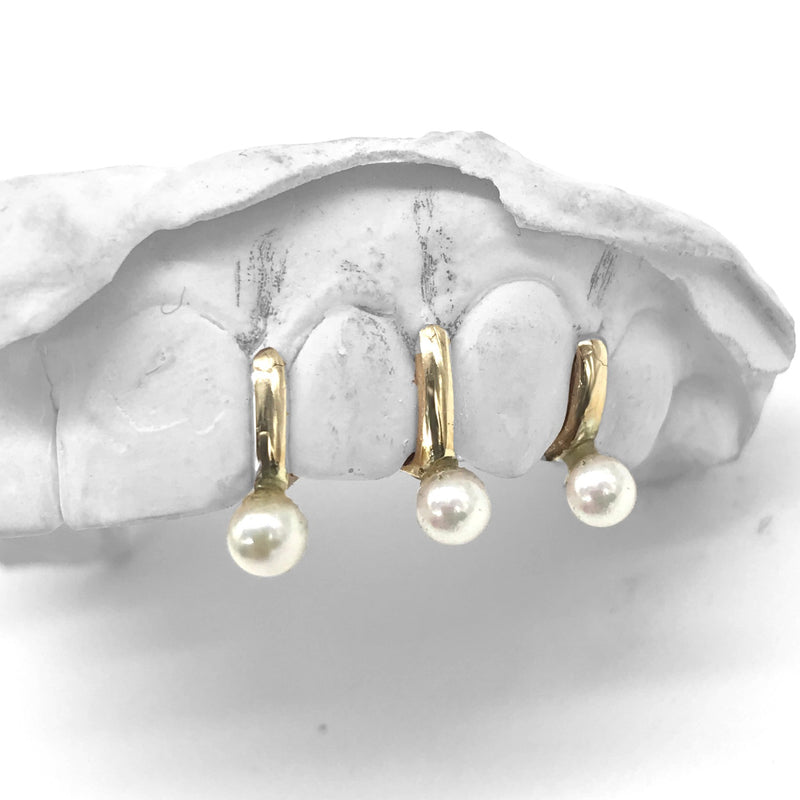 Pearl Gaps