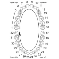 Pearl Gaps